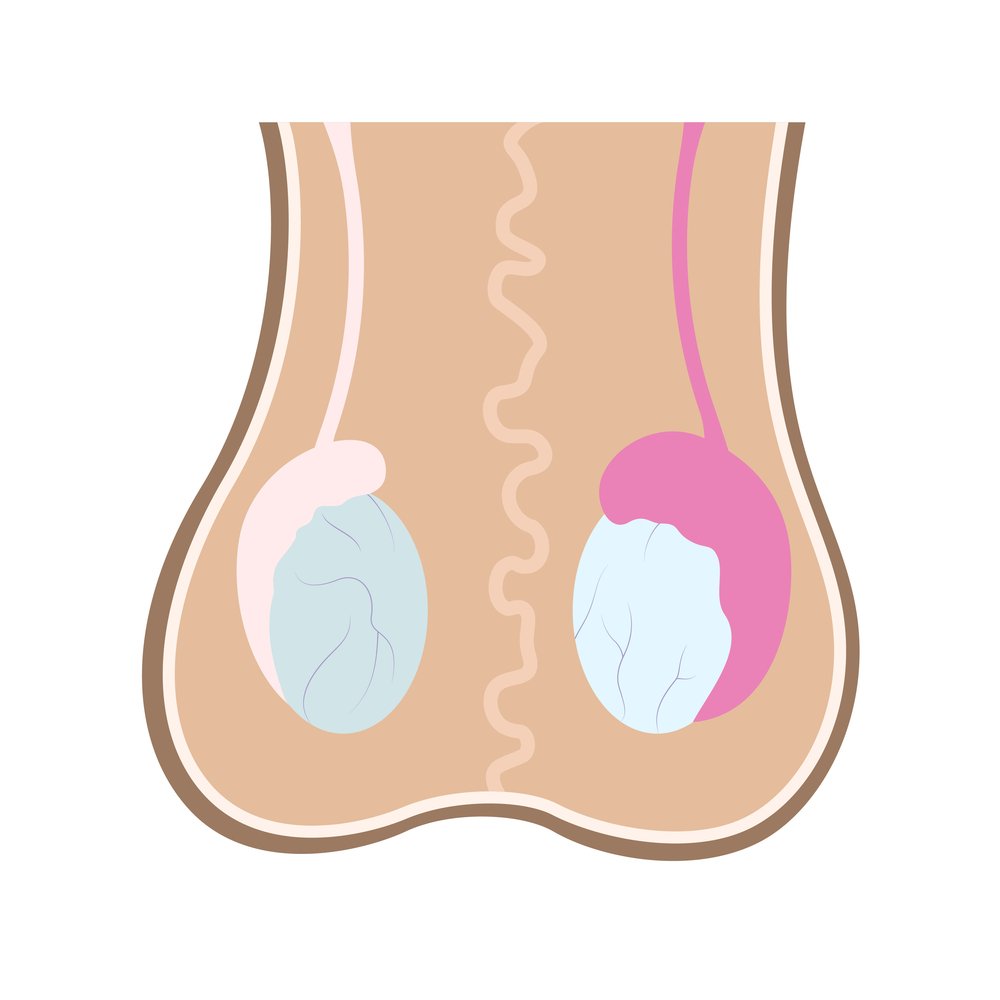 epididimite testiculo