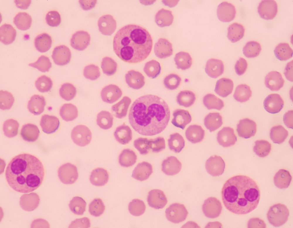 Neutrofilos no sangue