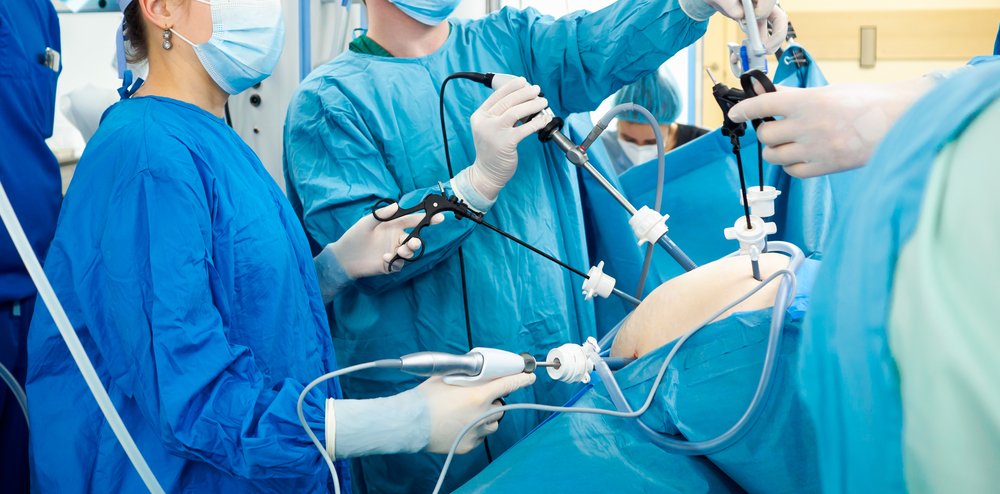 cirurgia por laparoscopia