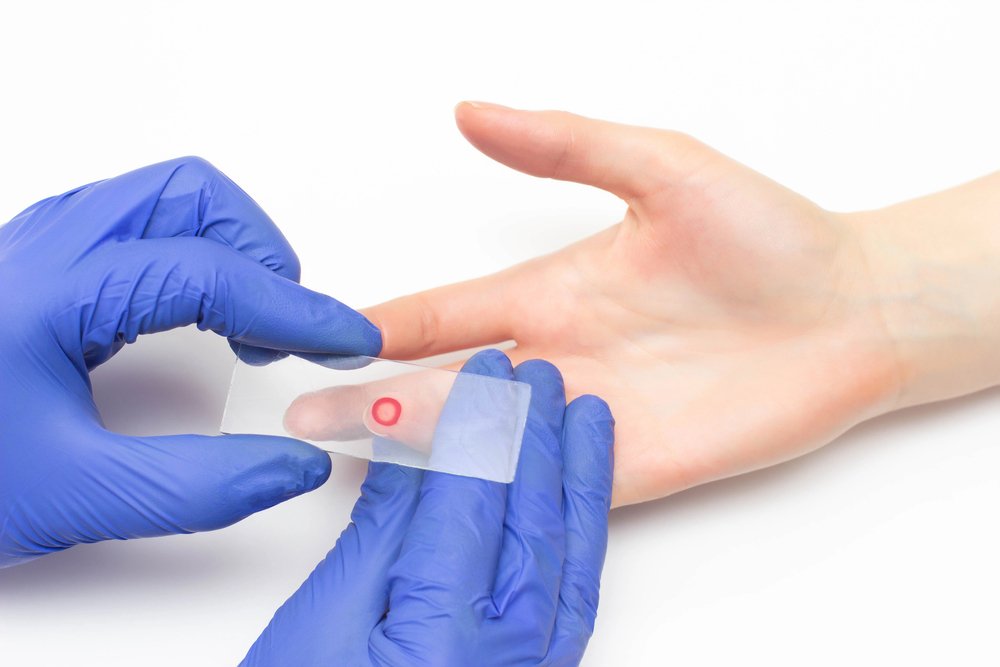 exame sangue dedo